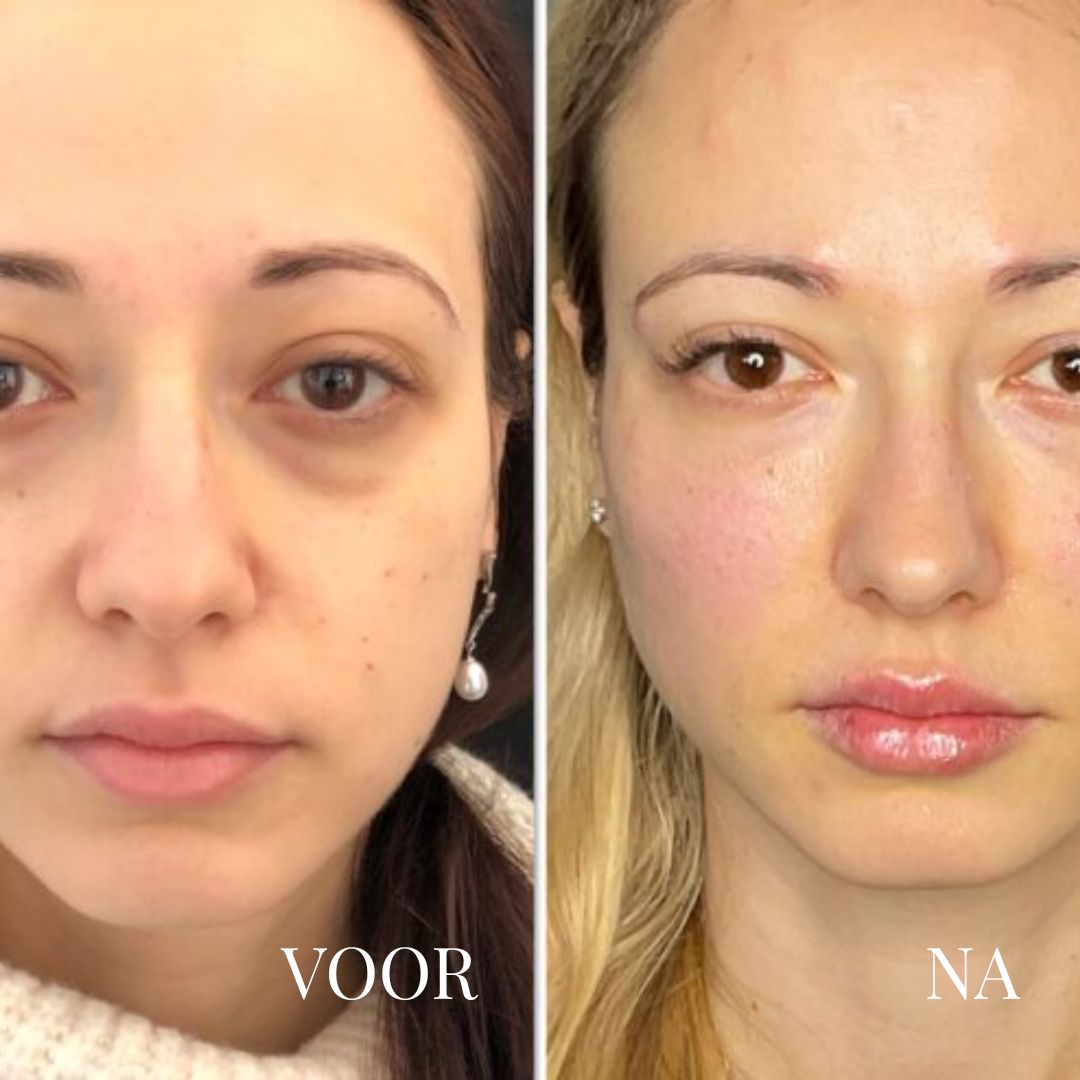 Dr. Melaxin | Morning Glow Corrector
