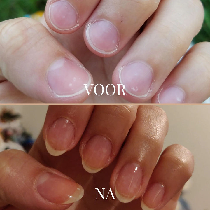 GentleGrip Elektrische Nagelknipper