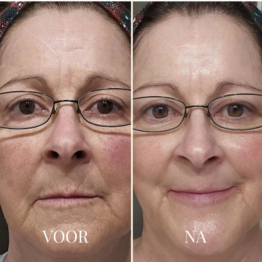 FRESHLIFT | KOREAANS COLLAGEENMASKER VOOR DE RIJPE HUID