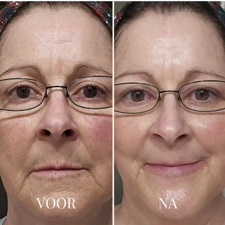 FRESHLIFT | KOREAANS COLLAGEENMASKER VOOR DE RIJPE HUID