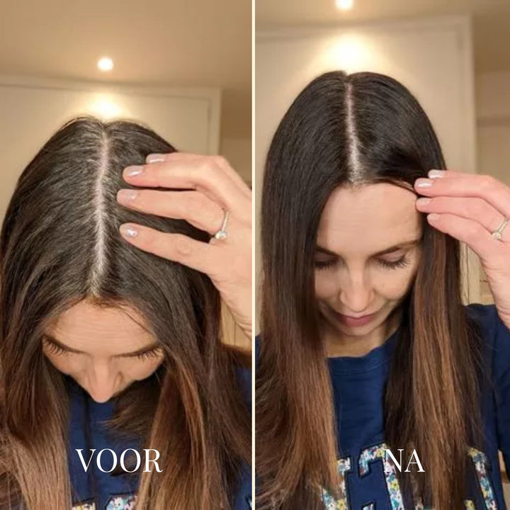 ROOTEASE ANSATZSTIFT