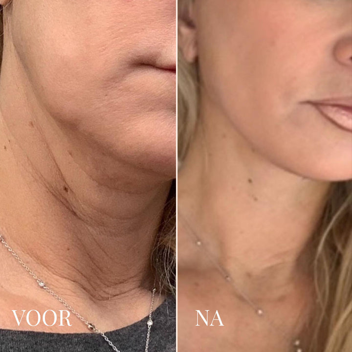 Viareline Collageen Masker