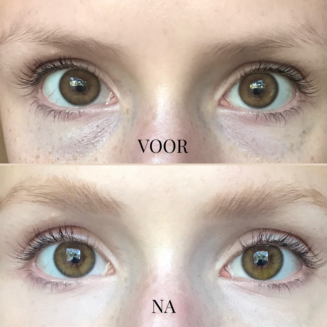 BrightFix Concealer