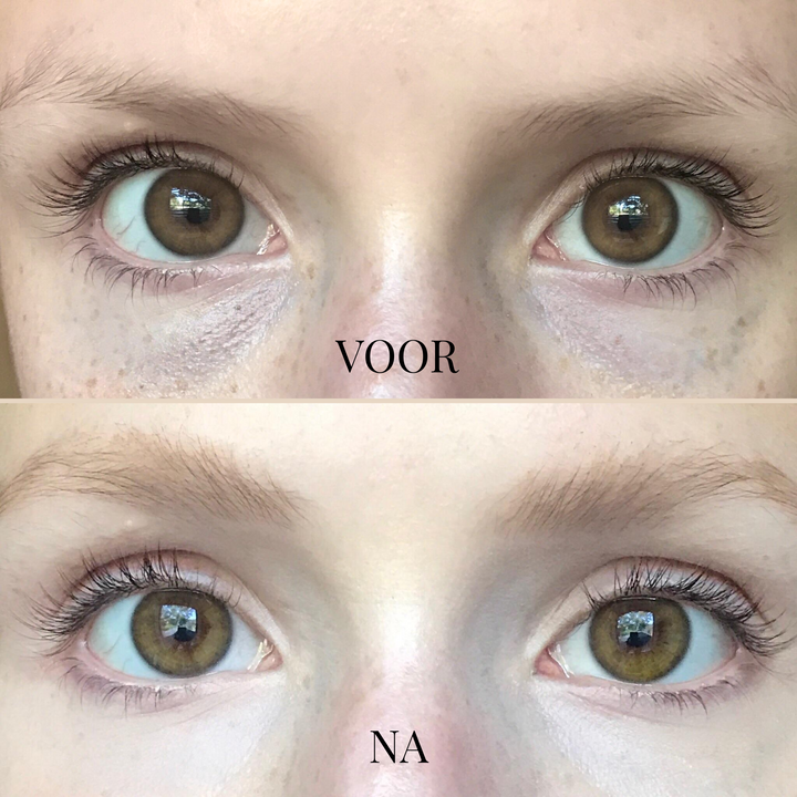 BrightFix Concealer