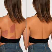 Nudaskin Body Coverage Concealer