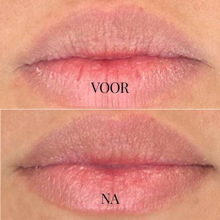 DewKiss Lippenbalsam