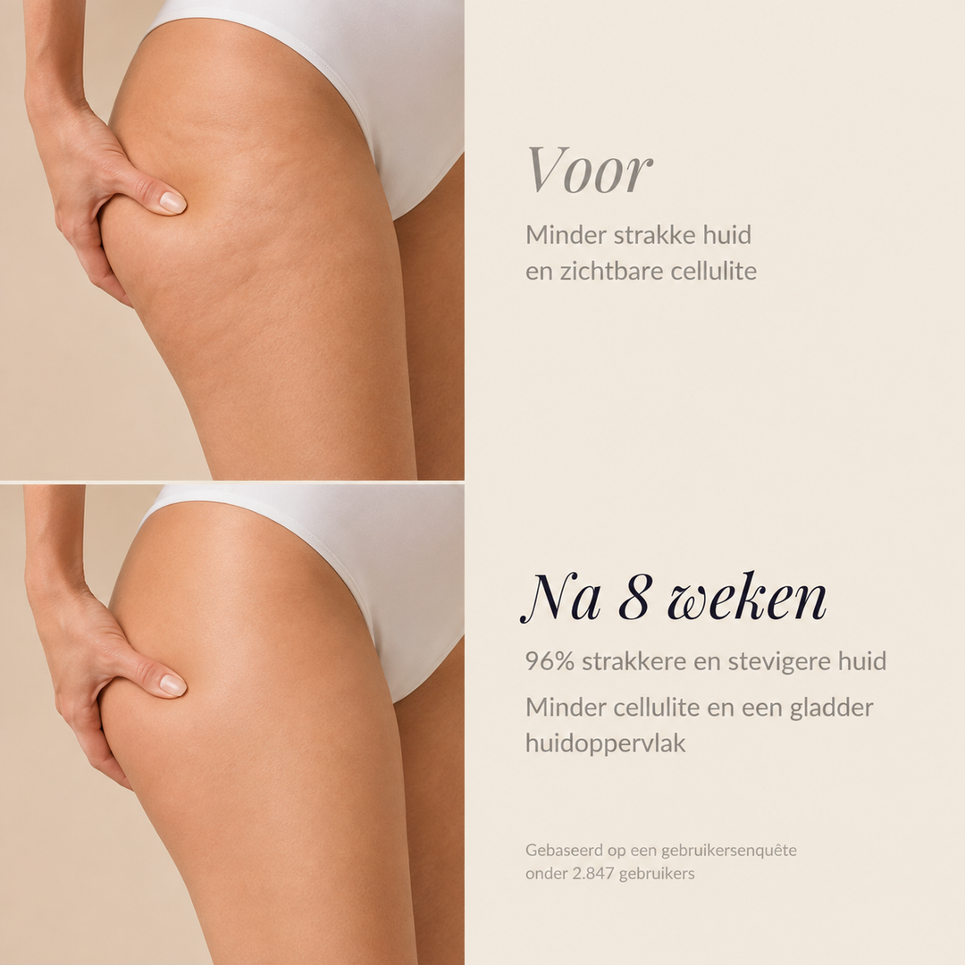 FormaLift™ | Een stevigere huid begint hier